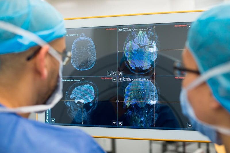 جدیدترین روش درمان تومور مغزی