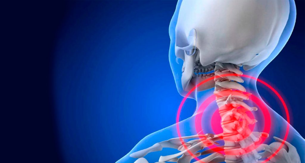 دیسک گردن و درد دست چپ چه ارتباطی باهم دارند؟