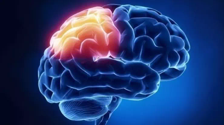  علائم خاموش تومور مغزی چیست